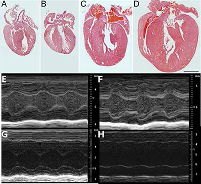 Increased Postnatal Cardiac Hyperplasia Precedes Cardiomyocyte Hypertrophy in a Model of Hypertrophic Cardiomyopathy